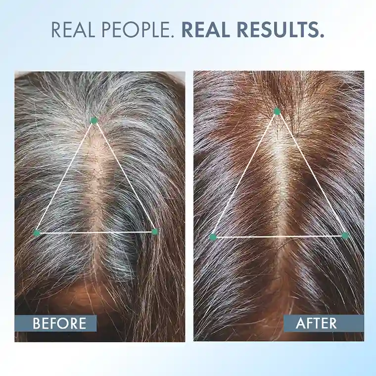 Anti Greying Hair Supplement, 30 capsules - Image 6