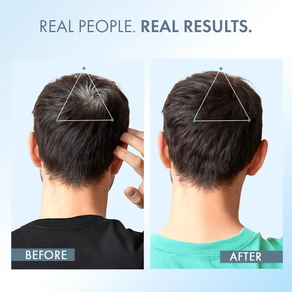 Anti Greying Hair Supplement, 30 capsules - Image 5