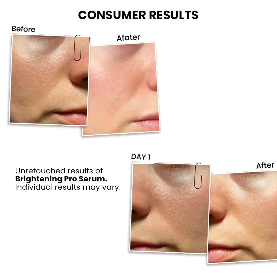 Brightening PRO Serum For Women, 30 ml - Image 7