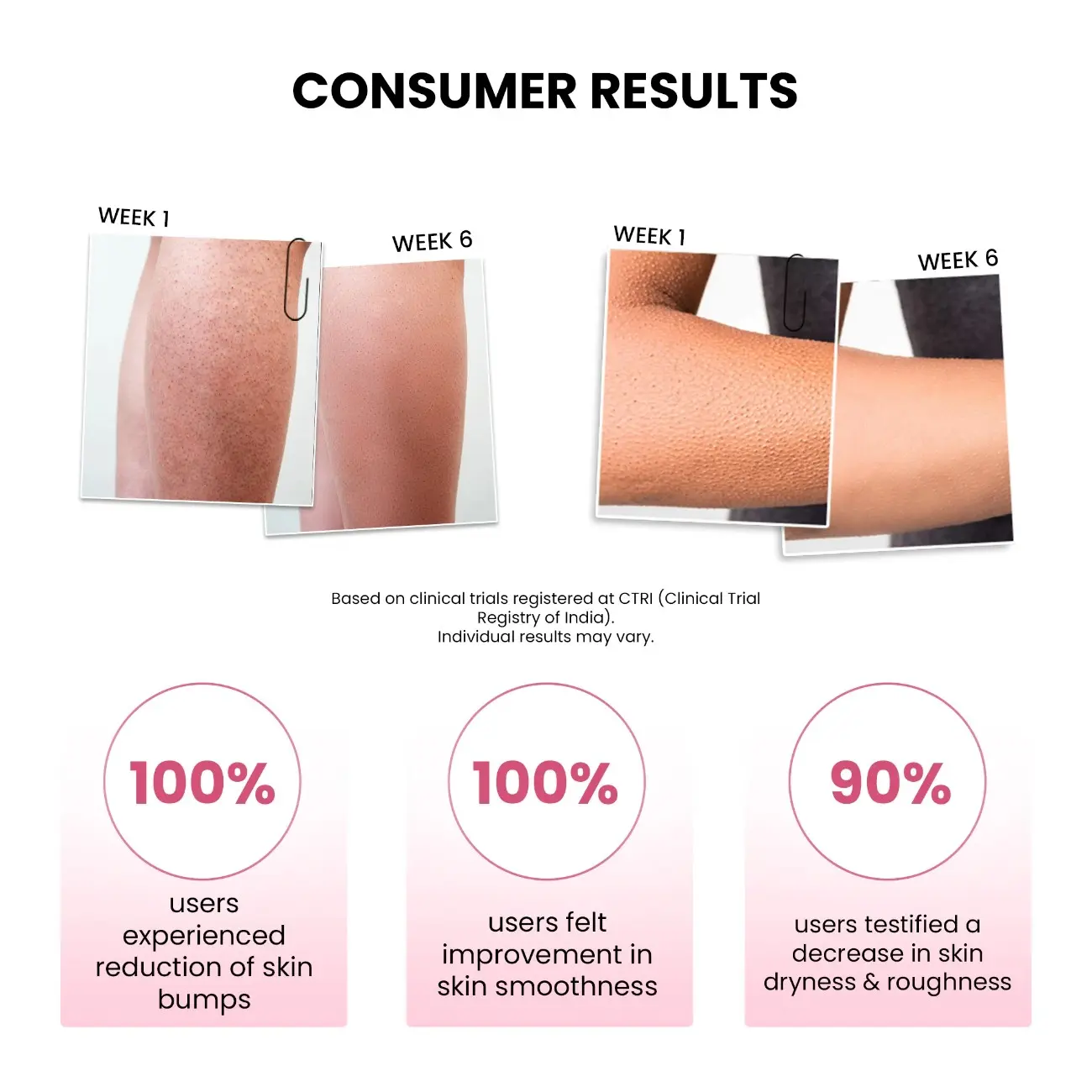 Smoothening Bumps Eraser Exfoliating Scrub, 100ml - Image 7