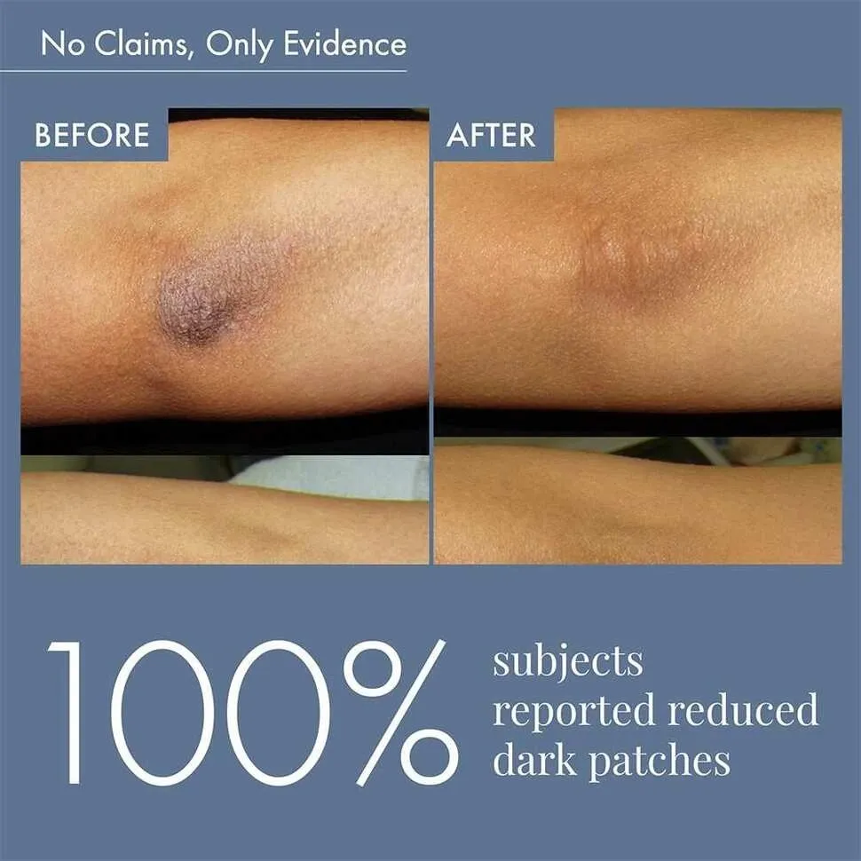 Dark Patches Corrector for Men & Women, 100ml - Image 5