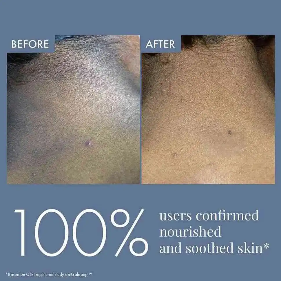 Dark Patches Corrector for Men & Women, 100ml - Image 7