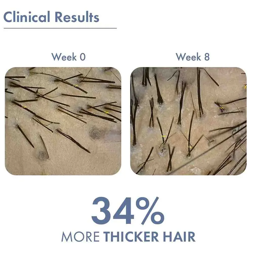 Hair Growth Serum 2.0 For Men & Women, 50ml - Image 10