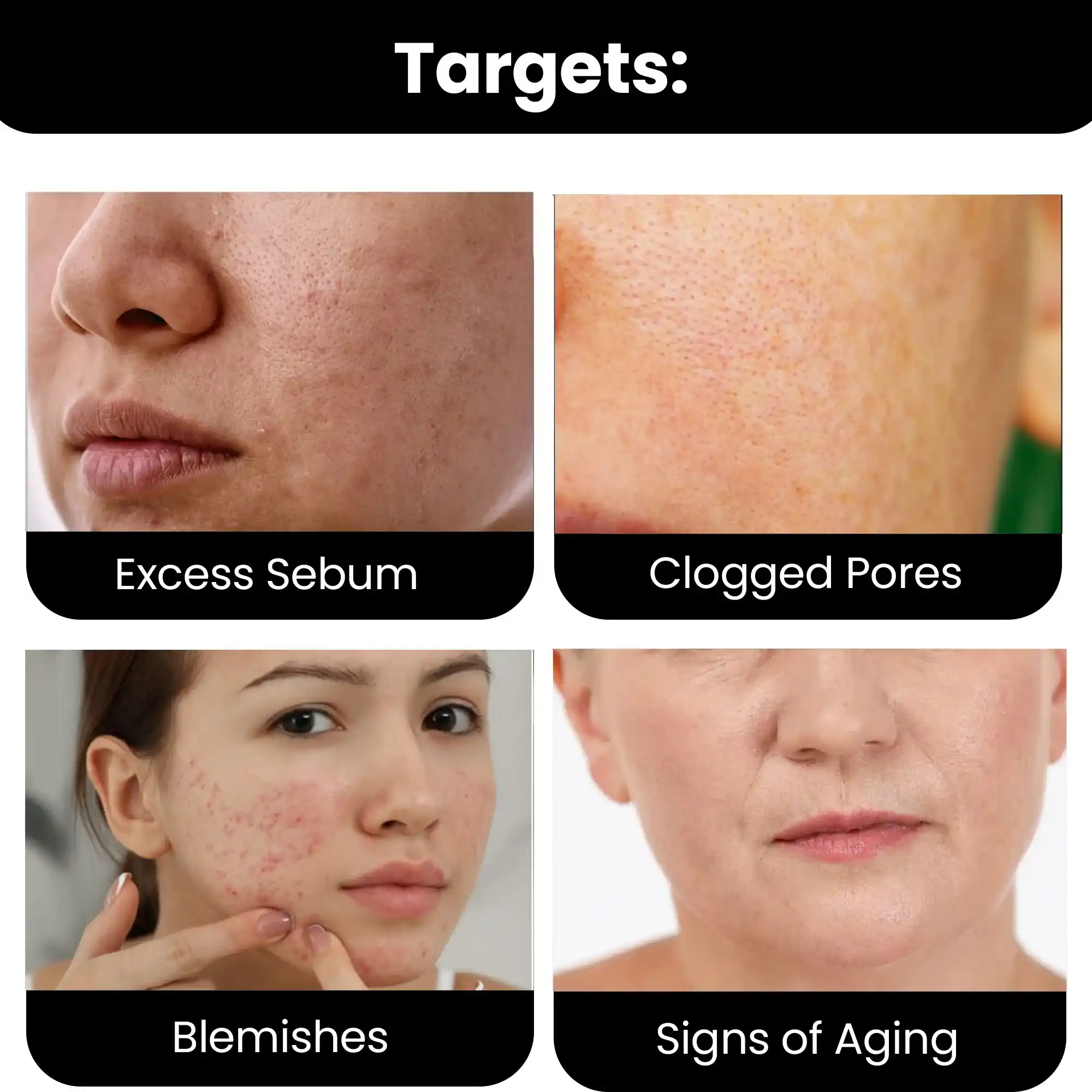 10% Niacinamide Serum with 1% Zinc PCA, 30ml - Image 3