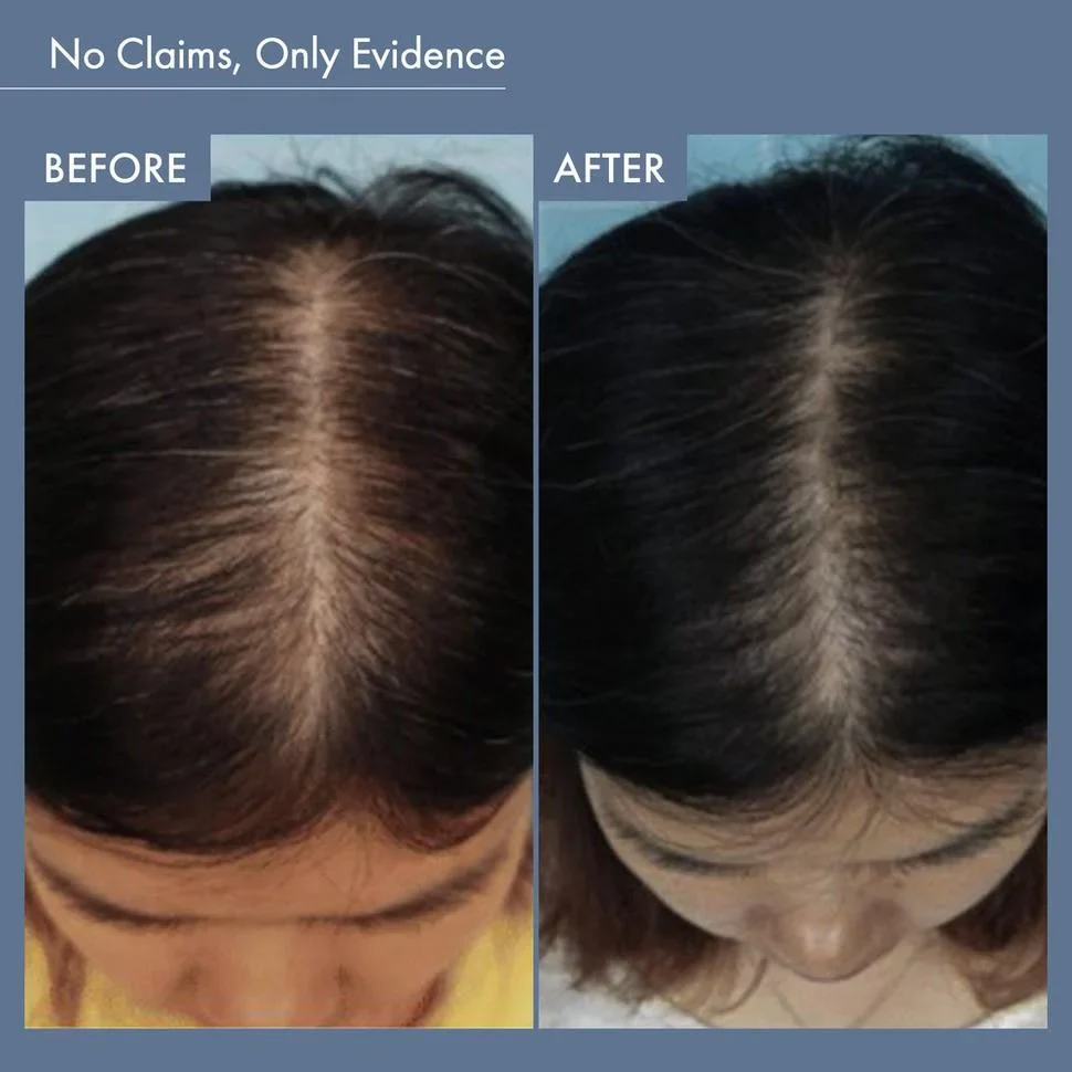 Rosemary Shampoo (250ml) + Rosemary Conditioner Combo (250ml) - Image 7