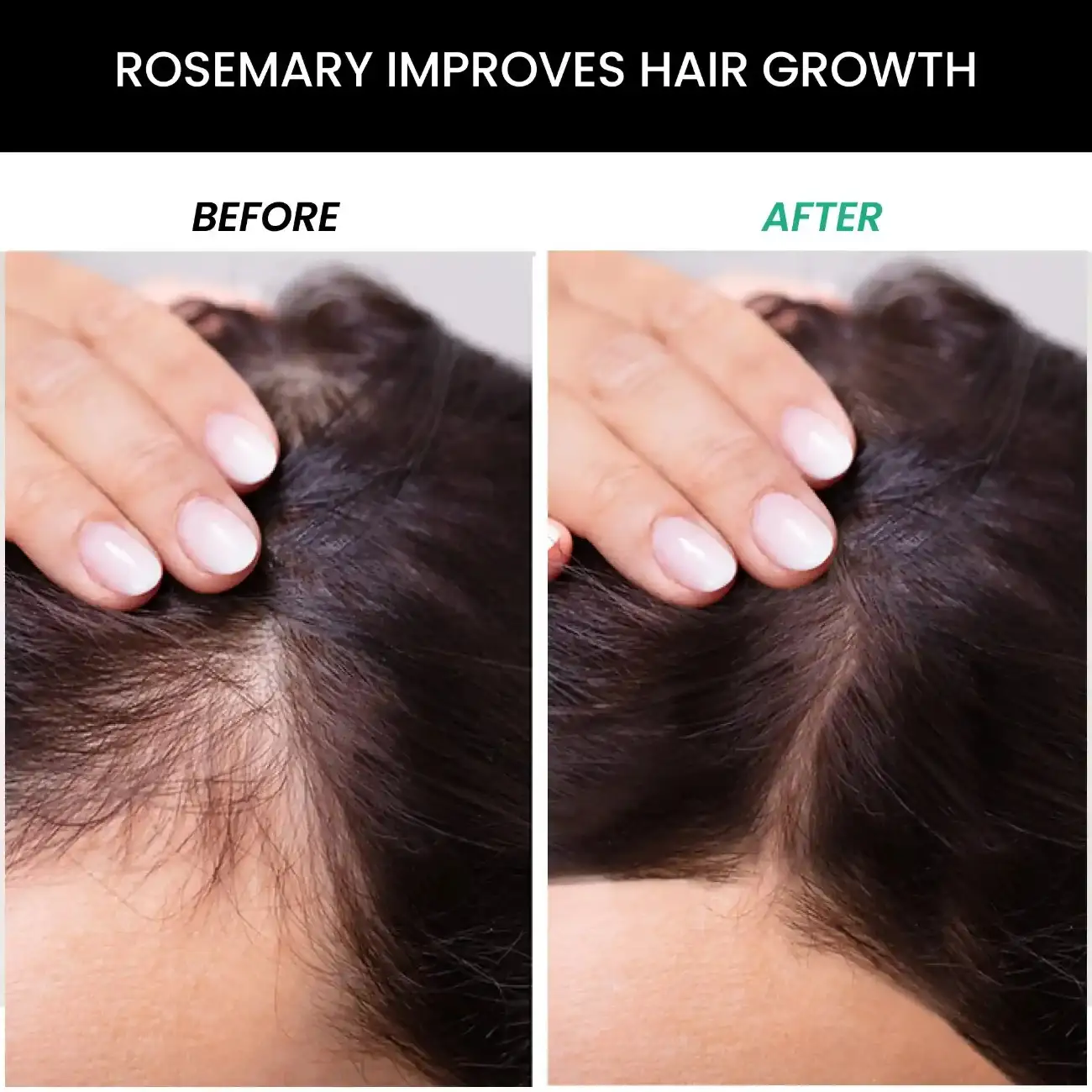 Rosemary Shampoo(250ml), Conditioner (250ml) & Rosemary Essential Oil (15ml) Combo - Image 3