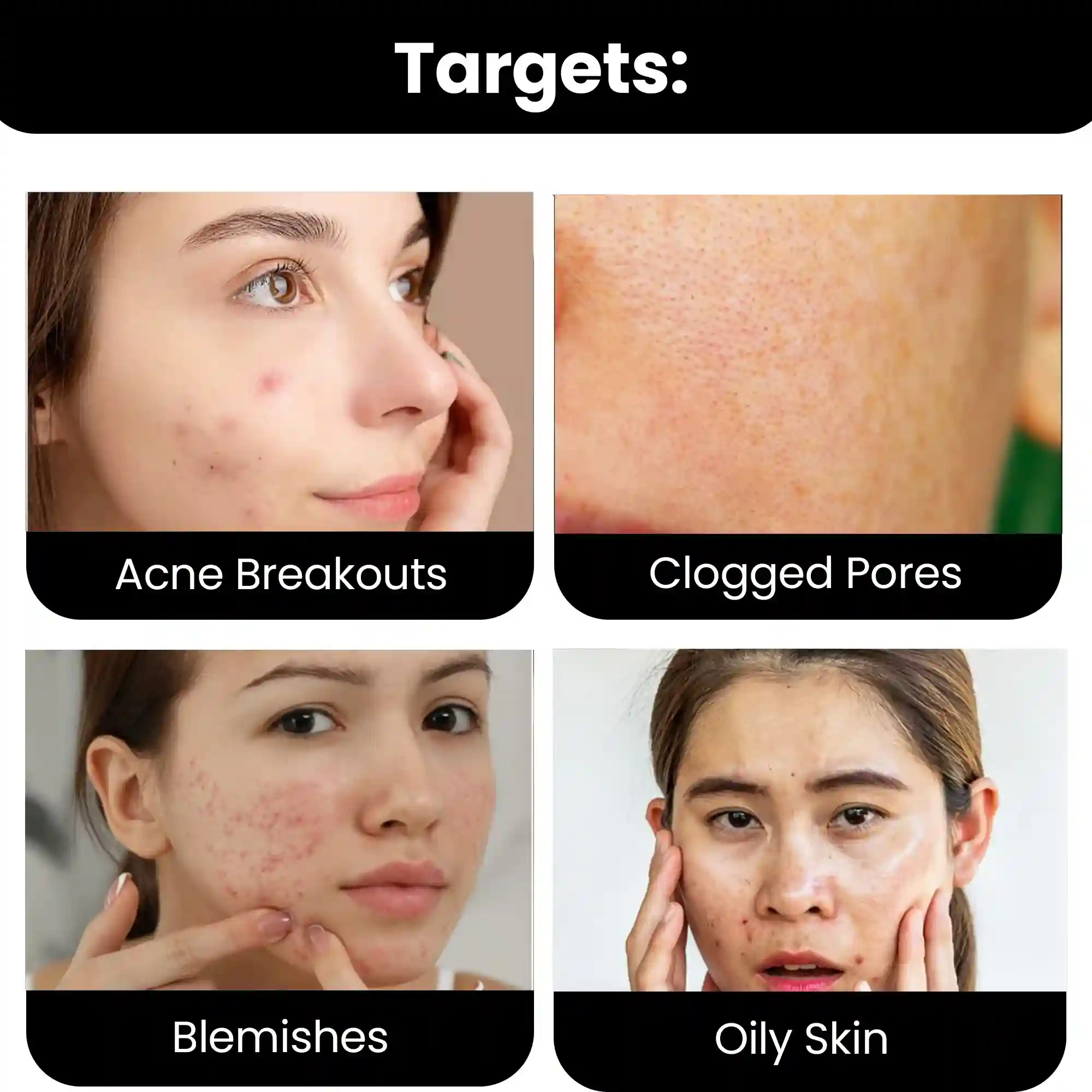 2% Salicylic acid Serum, 30ml - Image 3