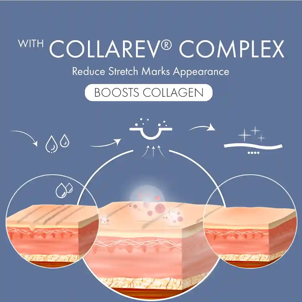 Stretch Marks Expert, Serum Cream, 30ml - Image 11