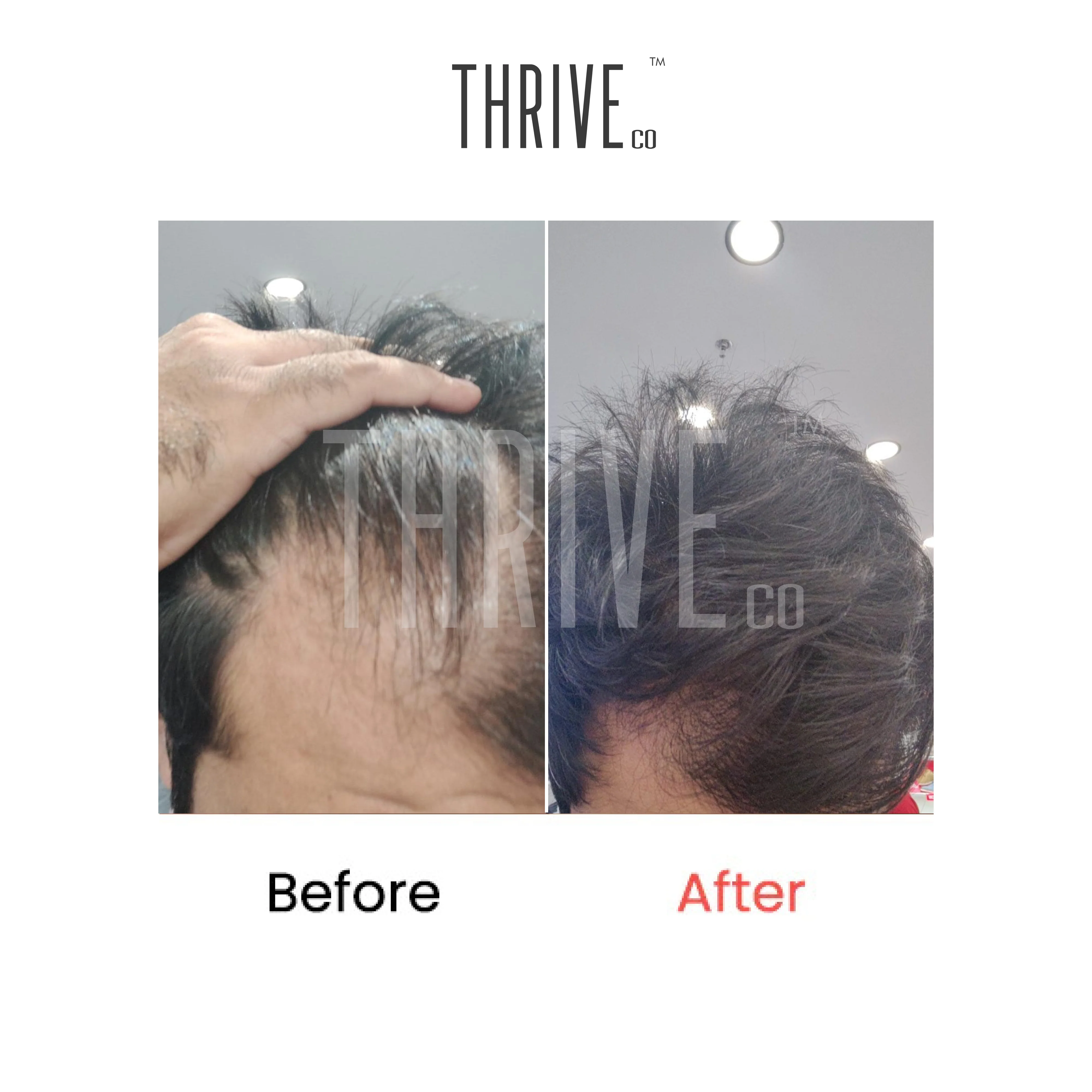 Hair Care Kit: ThriveCo Scalp Scrub (100ml) + Vitalizing Serum (50ml) + Hair Growth Serum (50ml) - Image 4