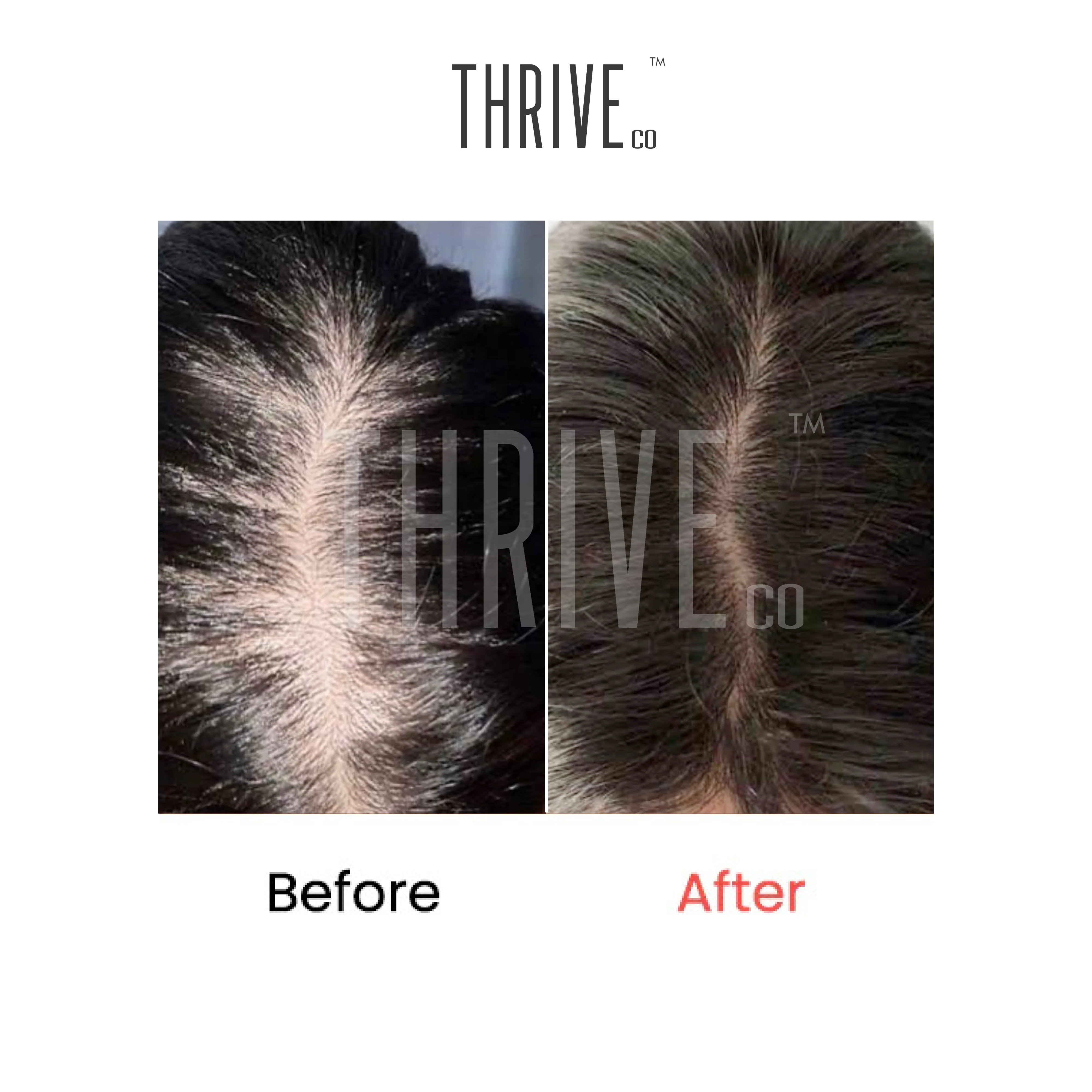 Hair Care Kit: ThriveCo Scalp Scrub (100ml) + Vitalizing Serum (50ml) + Hair Growth Serum (50ml) - Image 6