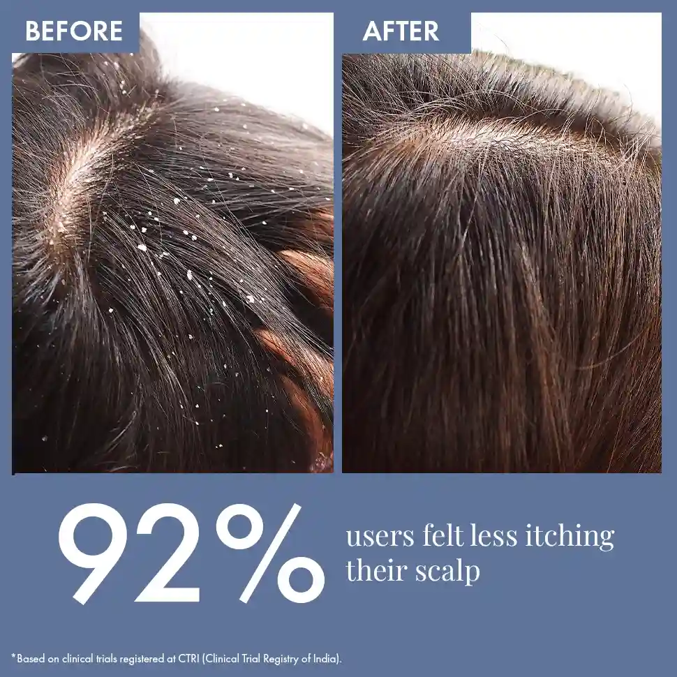 Scalp Clear Shampoo - Image 4