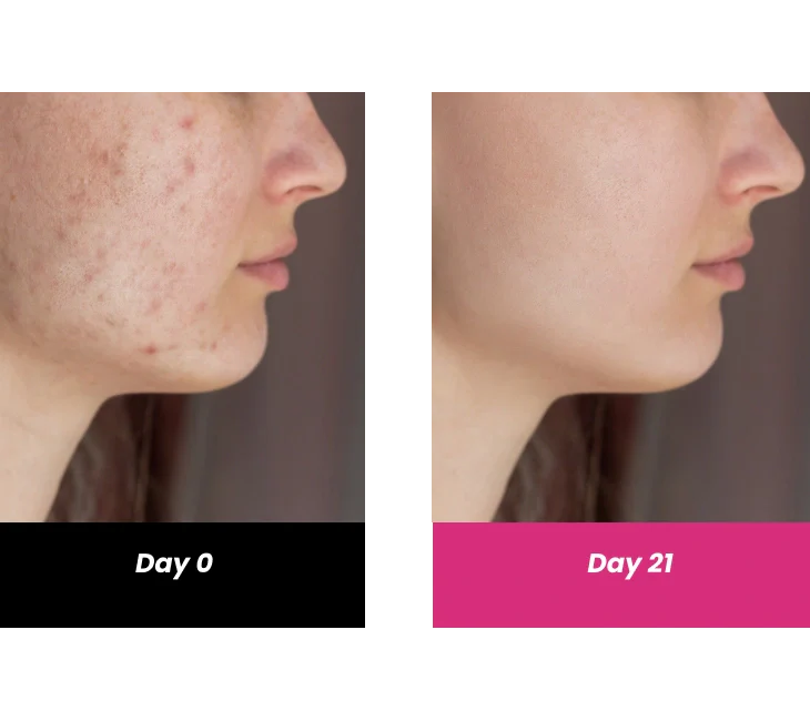 10% Vitamin C Serum with Hyaluronic Acid, 30ml - Image 4