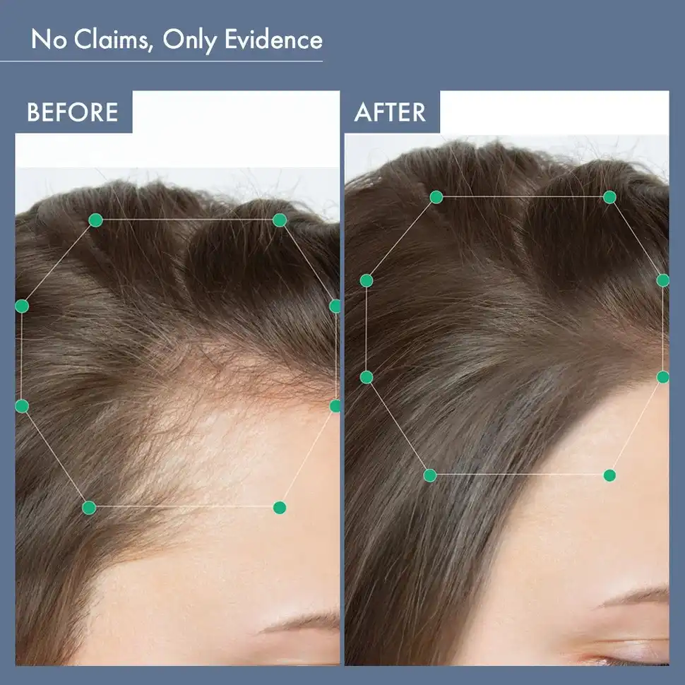 Women's Hair Growth Supplement, 60N Capsules - Image 5